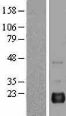 Western Blot: BAALC Overexpression Lysate [NBL1-07894]