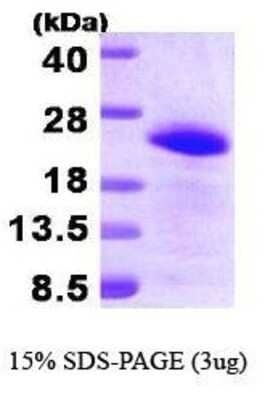 SDS-PAGE: Recombinant Human BAALC His Protein [NBP1-30302]