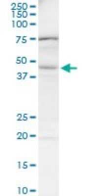 Western Blot: BAAT Antibody (1E4) [H00000570-M03]