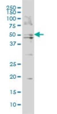 Western Blot: BAAT Antibody (5B6) [H00000570-M02]