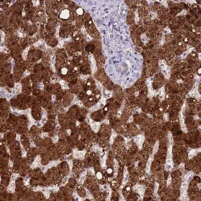 Immunohistochemistry-Paraffin: BAAT Antibody [NBP2-14344]