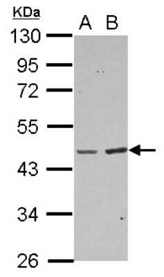 Western Blot: BAAT Antibody [NBP2-15535]