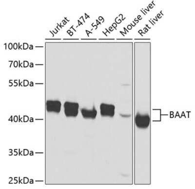 Western Blot: BAAT AntibodyBSA Free [NBP2-92503]