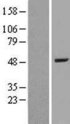 Western Blot: BAAT Overexpression Lysate [NBP2-09453]