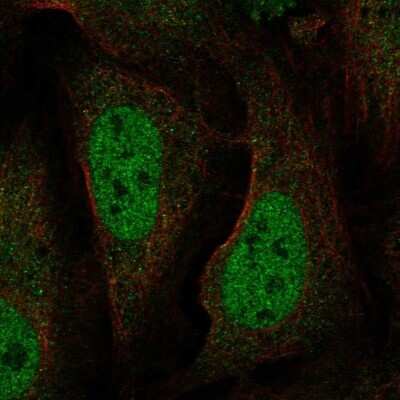 Immunocytochemistry/ Immunofluorescence: BAAT1 Antibody [NBP2-57563]