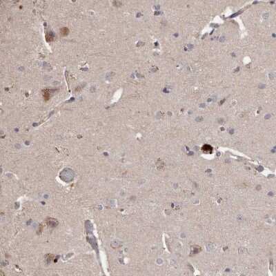 Immunohistochemistry-Paraffin: BAAT1 Antibody [NBP1-88366]