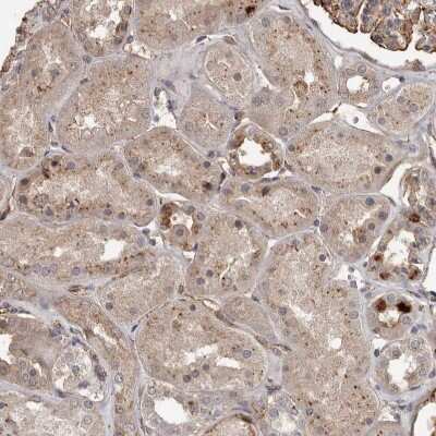 Immunohistochemistry-Paraffin: BAAT1 Antibody [NBP1-88366]