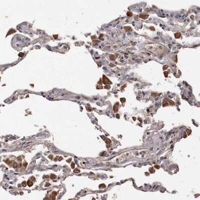 Immunohistochemistry-Paraffin: BAAT1 Antibody [NBP1-88366]