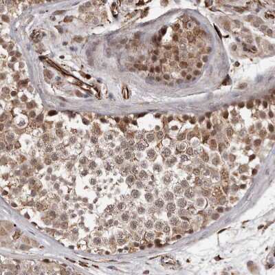 Immunohistochemistry-Paraffin: BAAT1 Antibody [NBP1-88366]