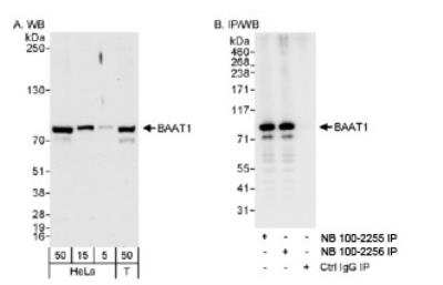 Western Blot: BAAT1 Antibody [NB100-2256]