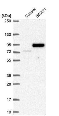 Western Blot: BAAT1 Antibody [NBP1-88366]