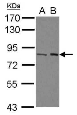 Western Blot: BAAT1 Antibody [NBP2-15536]