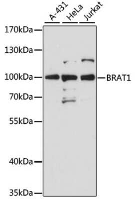 Western Blot: BAAT1 AntibodyAzide and BSA Free [NBP2-92706]