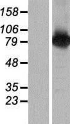 Western Blot: BAAT1 Overexpression Lysate [NBP2-05312]