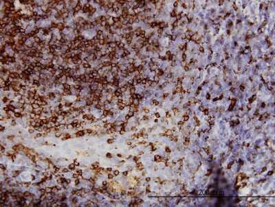 Immunohistochemistry-Paraffin: BACE-1 Antibody (2C1) [H00023621-M01]