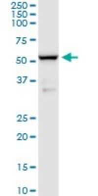 Western Blot: BACE-1 Antibody (2C1) [H00023621-M01]