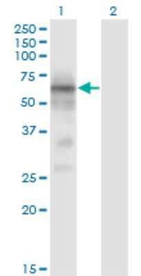Western Blot: BACE-1 Antibody (2C1) [H00023621-M01]