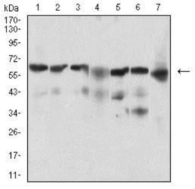 Western Blot: BACE-1 Antibody (3C1C3)BSA Free [NBP2-37261]