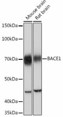 Western Blot: BACE-1 Antibody (7C5T7) [NBP3-15398]