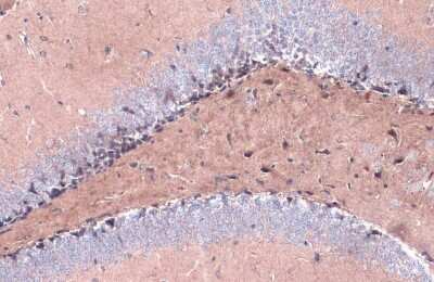 Immunohistochemistry-Paraffin: BACE-1 Antibody [NBP3-13390]