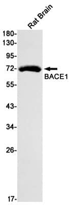 Western Blot: BACE-1 Antibody (S03-9C8) [NBP3-19577]