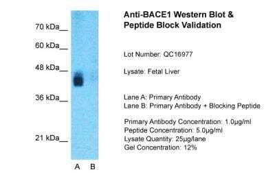 Western Blot: BACE-1 Antibody [NBP1-62416]