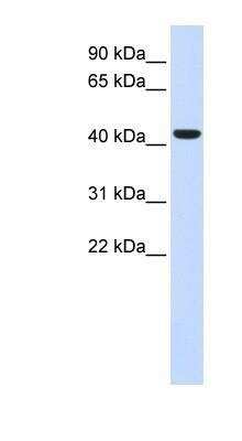Western Blot: BACE-1 Antibody [NBP1-62416]