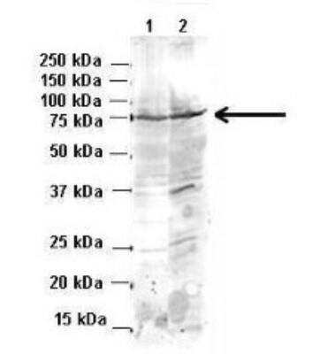 Western Blot: BACE-1 Antibody [NBP1-62416]