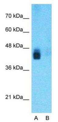 Western Blot: BACE-1 Antibody [NBP1-62416]