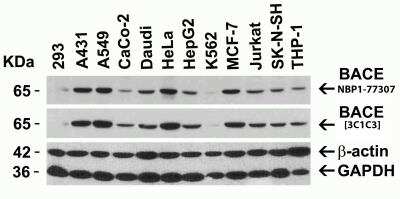 Western Blot: BACE-1 AntibodyBSA Free [NBP1-77307]