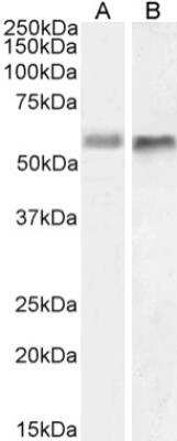 Western Blot: BACE-2 Antibody (1/ 9)Azide and BSA Free [NBP2-81075]