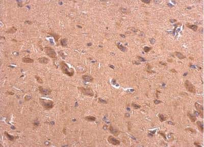 Immunohistochemistry-Paraffin: BACE-2 Antibody [NBP2-15539]