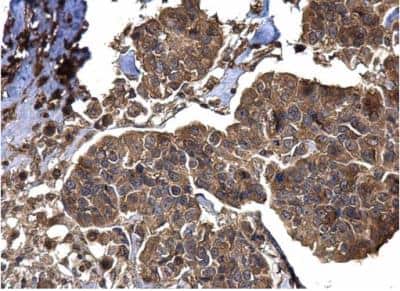 Immunohistochemistry-Paraffin: BACE-2 Antibody [NBP2-15539]