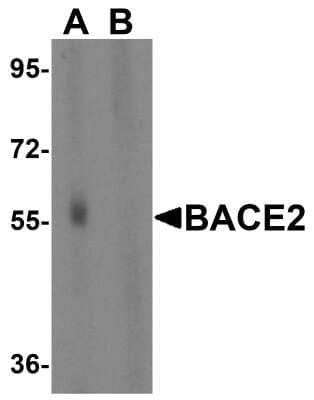 Western Blot: BACE-2 AntibodyBSA Free [NBP1-77308]