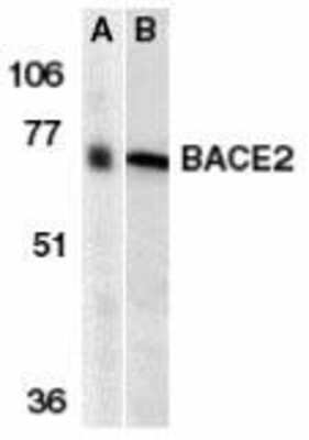 Western Blot: BACE-2 AntibodyBSA Free [NBP1-77309]