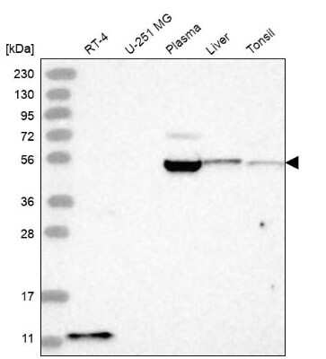 Western Blot: BACE-2 Antibody [NBP2-68624]