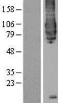 Western Blot: BACE-1 Overexpression Lysate [NBP2-04325]