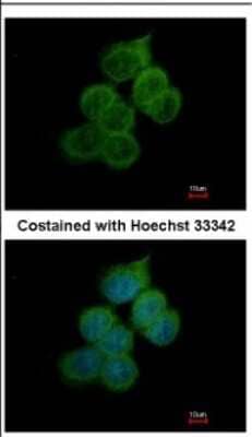 Immunocytochemistry/ Immunofluorescence: BACE-2 Antibody [NBP2-15539]