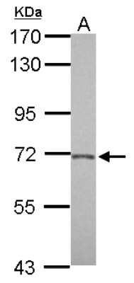 Western Blot: BACE-2 Antibody [NBP2-15539]