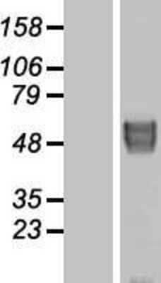 Western Blot: BACE-2 Overexpression Lysate [NBP2-07491]