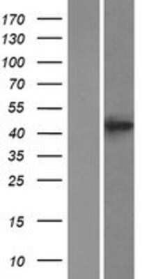 Western Blot: BACE-2 Overexpression Lysate [NBP2-09973]