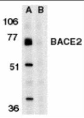 Western Blot: BACE-2 Antibody Blocking Peptide [NBP1-77308PEP]