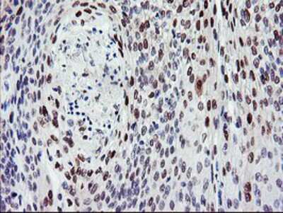 Immunohistochemistry-Paraffin: BACH1 Antibody (OTI4E11) [NBP2-01904]