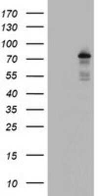 Western Blot: BACH1 Antibody (OTI4E11) [NBP2-01904]