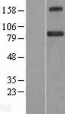 Western Blot: BACH1 Overexpression Lysate [NBL1-07898]