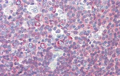 Immunohistochemistry: BACH2 Antibody [NBP2-87062]
