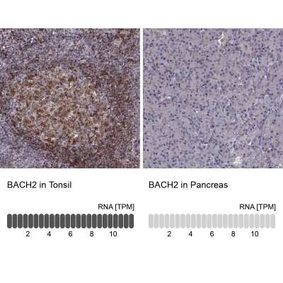 Immunohistochemistry-Paraffin: BACH2 Antibody [NBP2-14345]