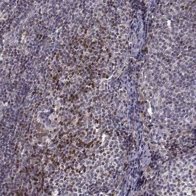 Immunohistochemistry-Paraffin: BACH2 Antibody [NBP2-14345]