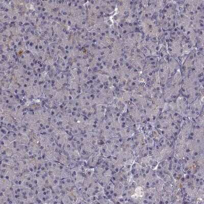 Immunohistochemistry-Paraffin: BACH2 Antibody [NBP2-14345]