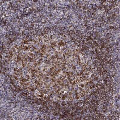 Immunohistochemistry-Paraffin: BACH2 Antibody [NBP2-14345]